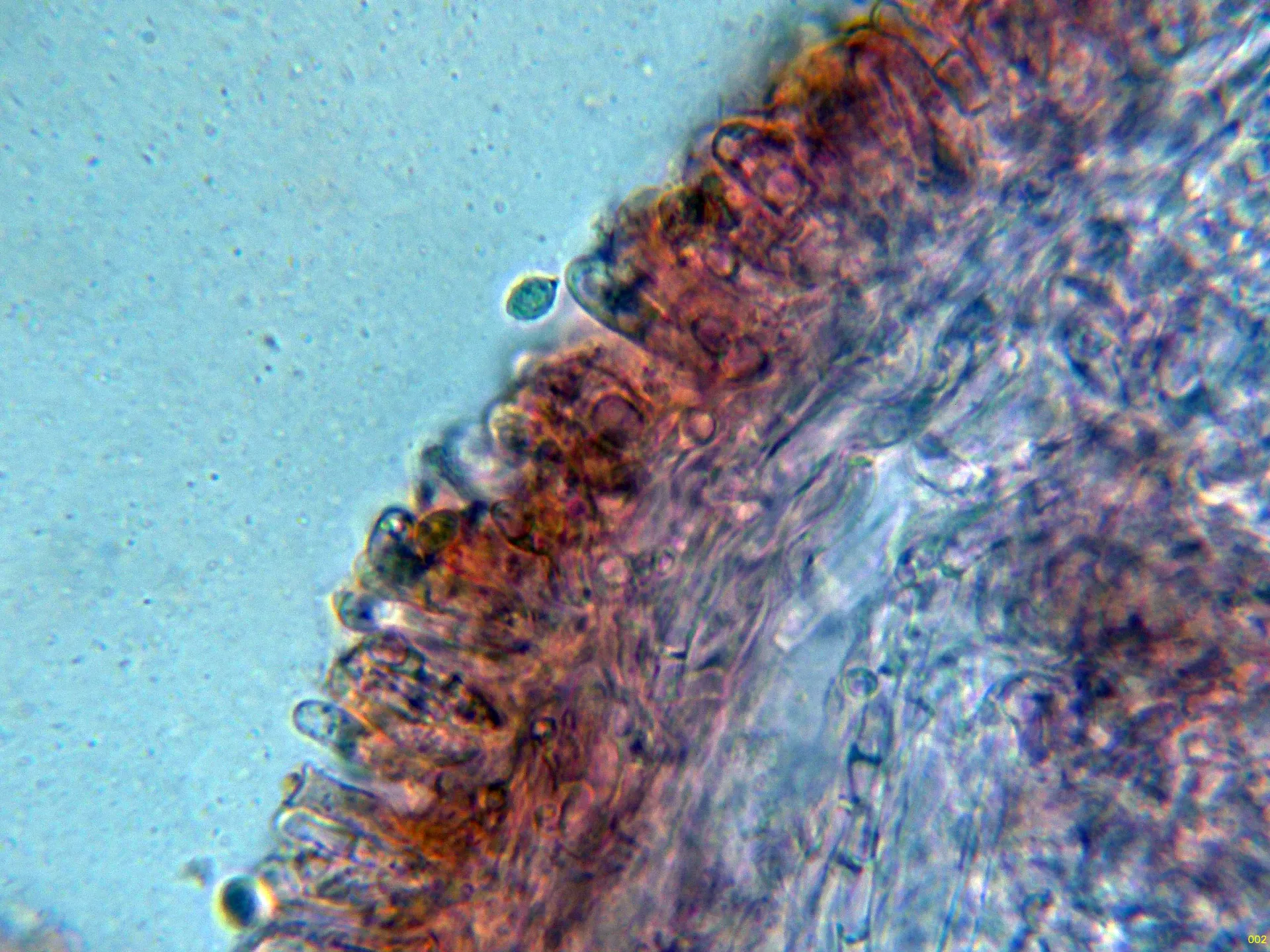 Microscopía de Clitopilus geminus - 10 - Arista laminar-002